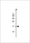 UBE2N Antibody (Center)